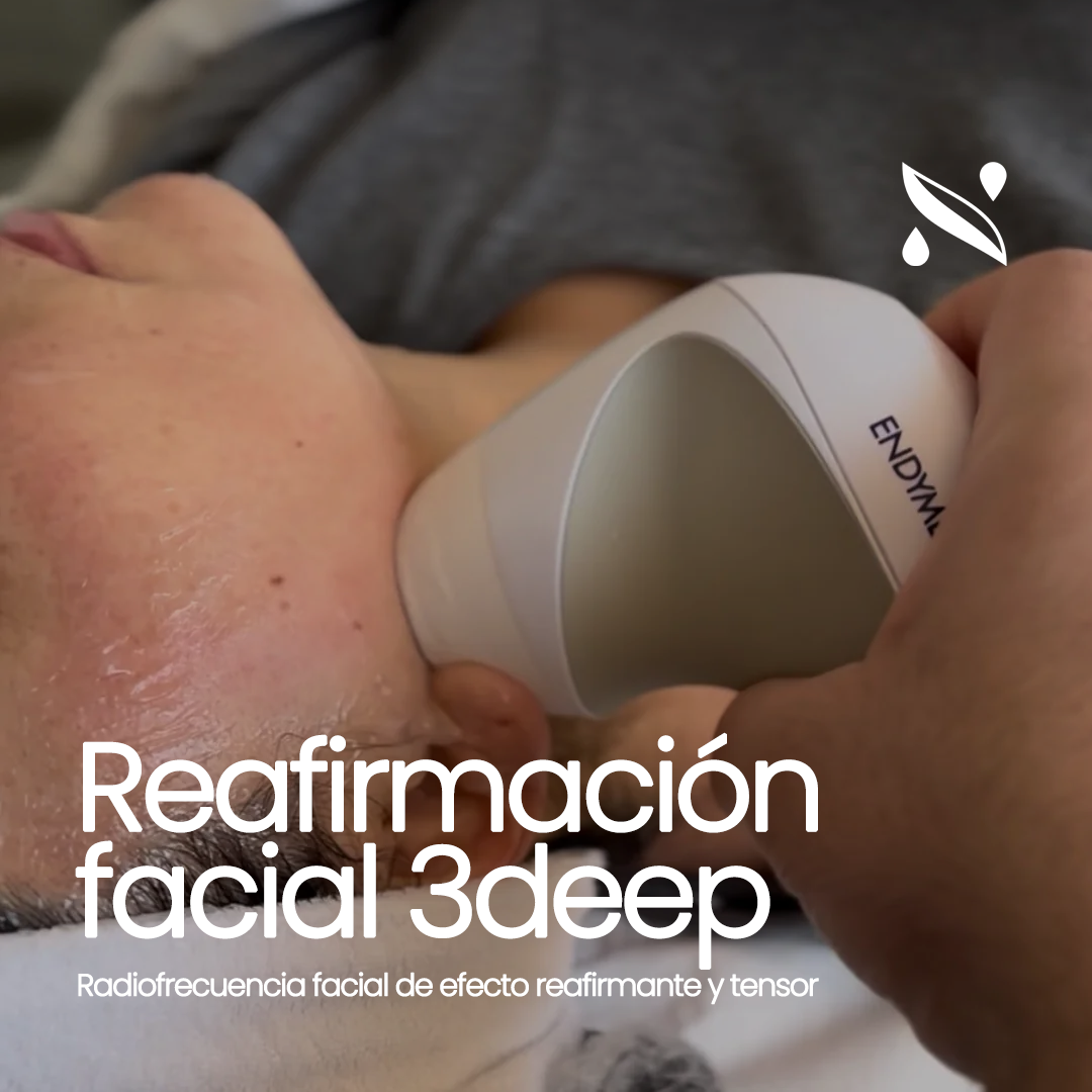 MiniShaper Facial – Radiofrecuencia Reafirmante 3DEEP® | EndyMed