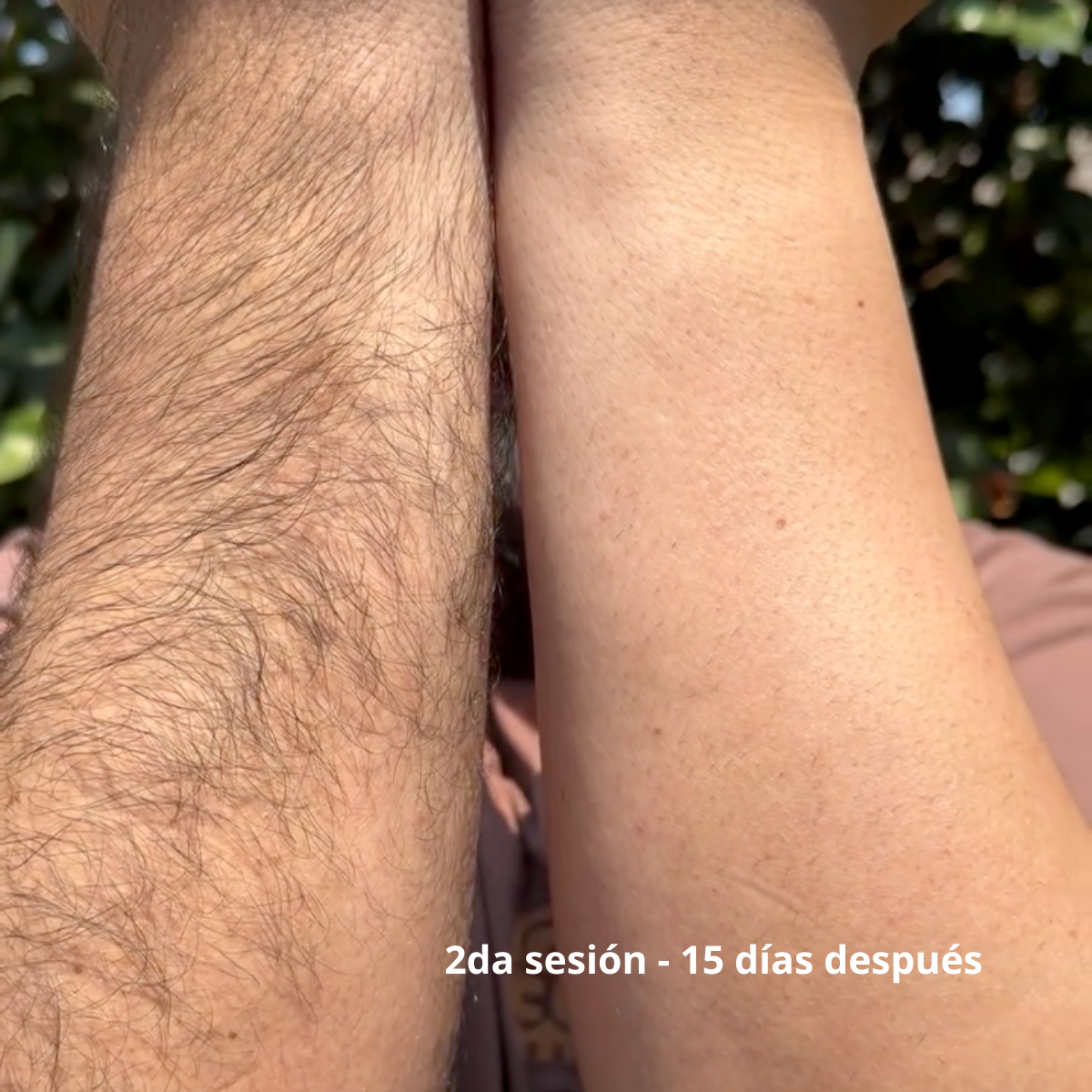 Brazos Completos 6 Sesiones Hombre