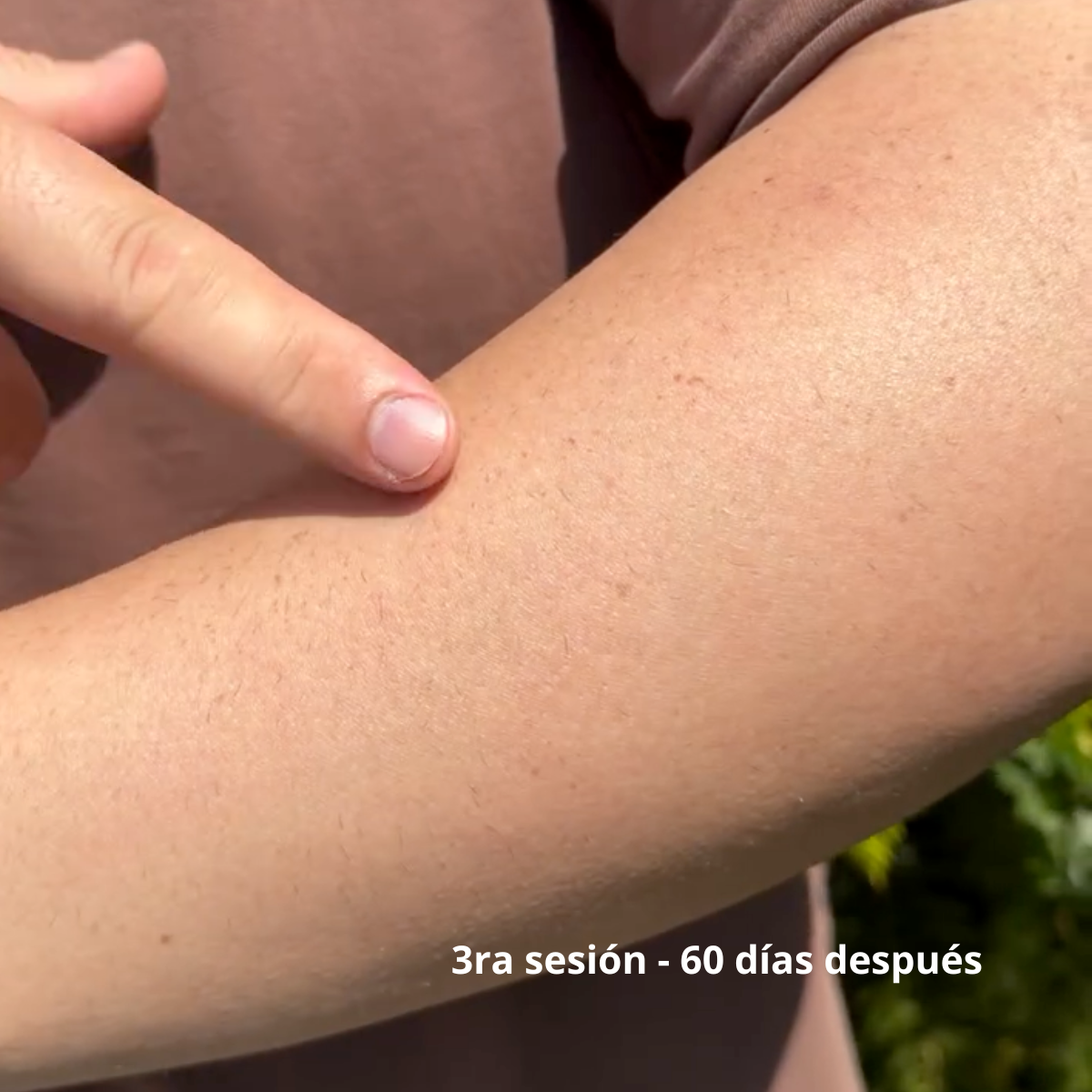 Brazos Completos 6 Sesiones Hombre