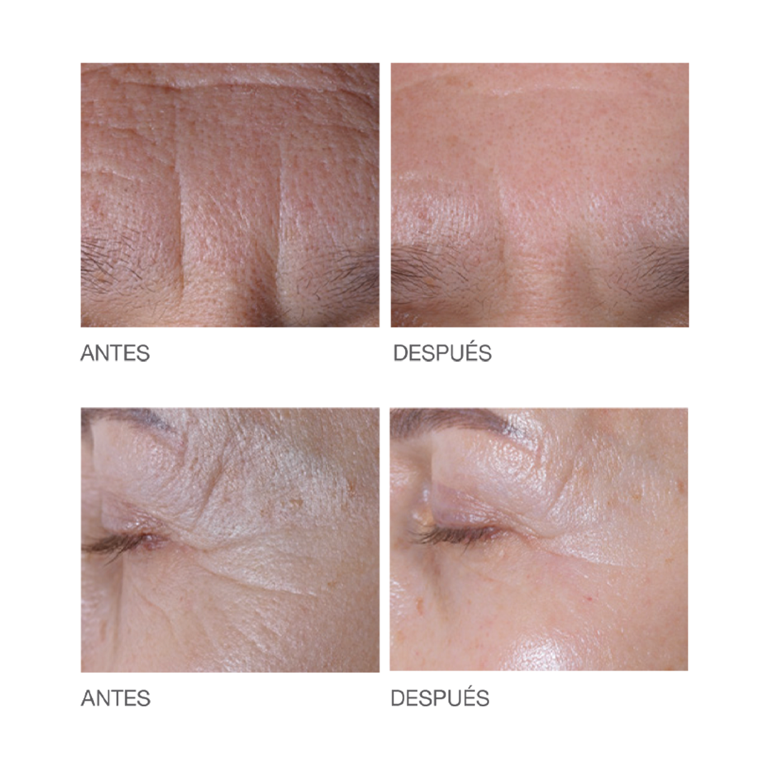 Timexpert-Wrinkless-2