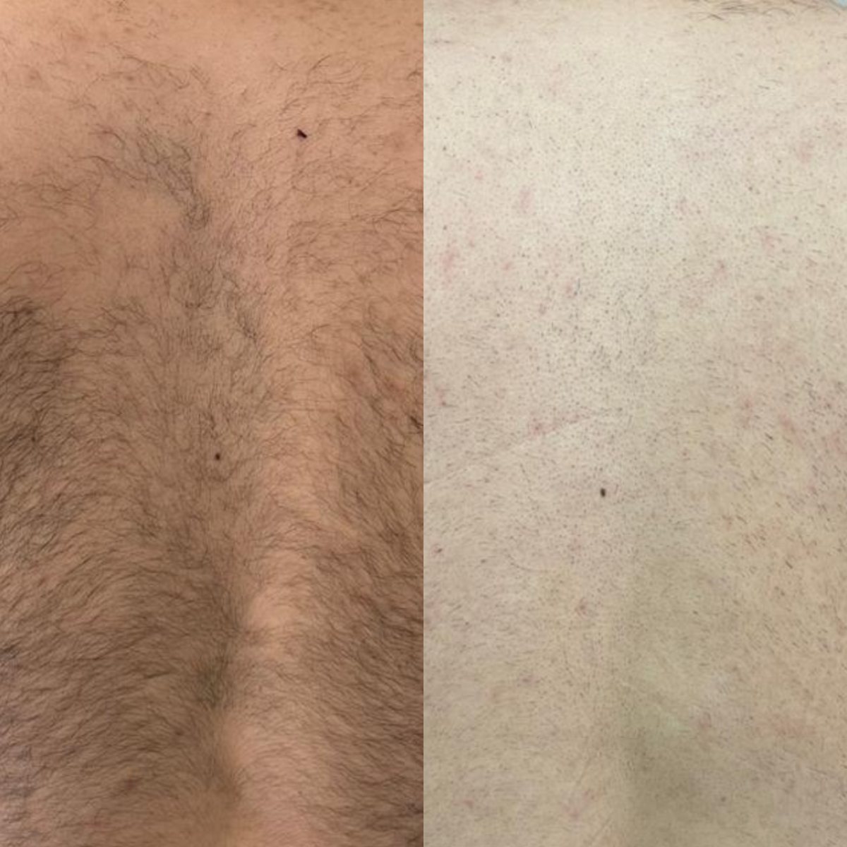 Espalda completa 6 Sesiones Hombre