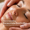 microneedling Exosomas Exocobio