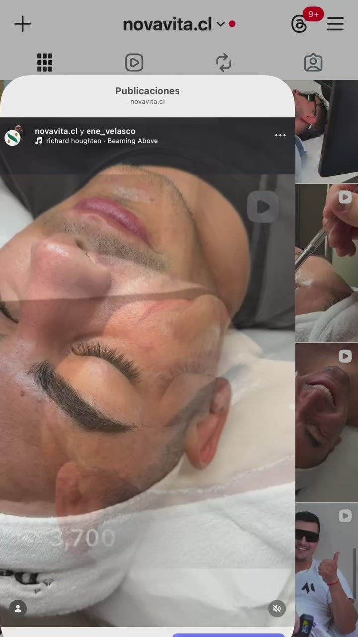 Limpieza Facial Profunda - Acné