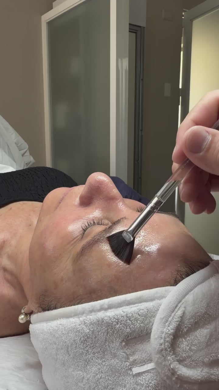 Limpieza Facial Profunda con Peeling de Peptidos